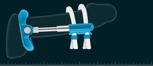 Unlock Unparalleled Pleasure with the 6 Best Penis Extenders of 2026! Here’s Our List of Top-Rated Products!